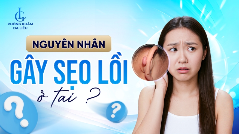 Sẹo lồi ở tai