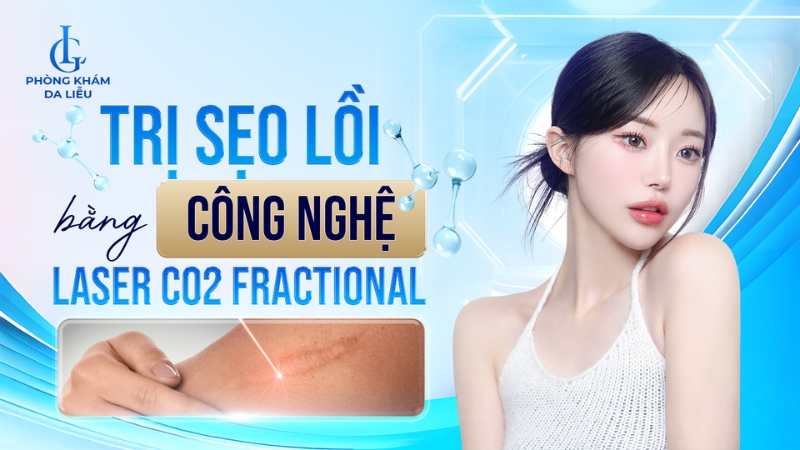 Trị sẹo lồi bằng công nghệ laser co2 fractional