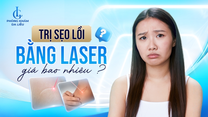Trị sẹo lồi bằng laser giá bao nhiêu?