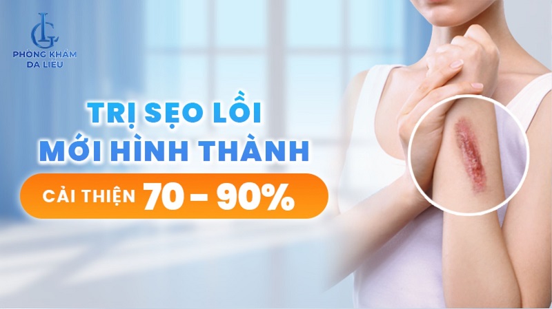 trị sẹo lồi mới hình thành